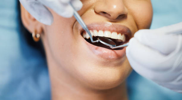 Best Emergency Tooth Extraction in Chenoa, IL