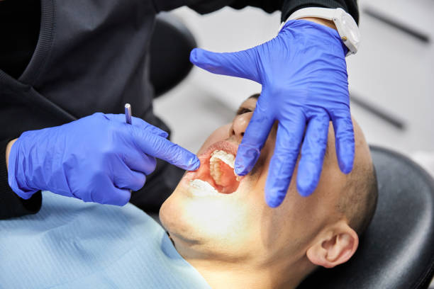 Best Same-Day Emergency Dental Services in Chenoa, IL
