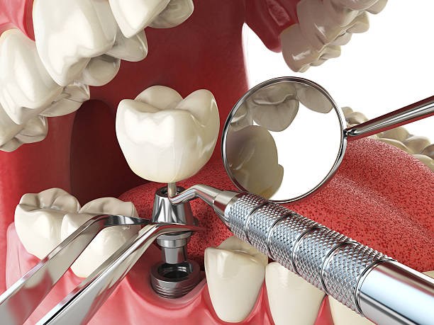 Best Urgent Care for Lost Fillings or Crowns in Chenoa, IL